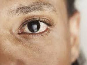 Boric Acid Solution For Human Eyes
